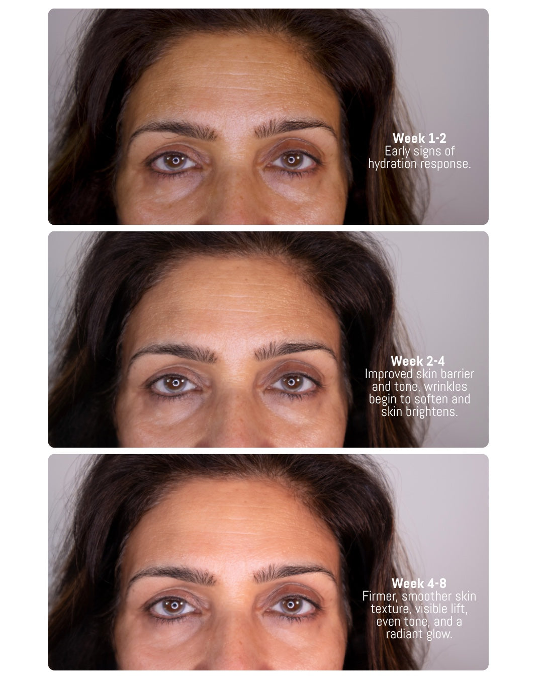 skin improvement pdrn