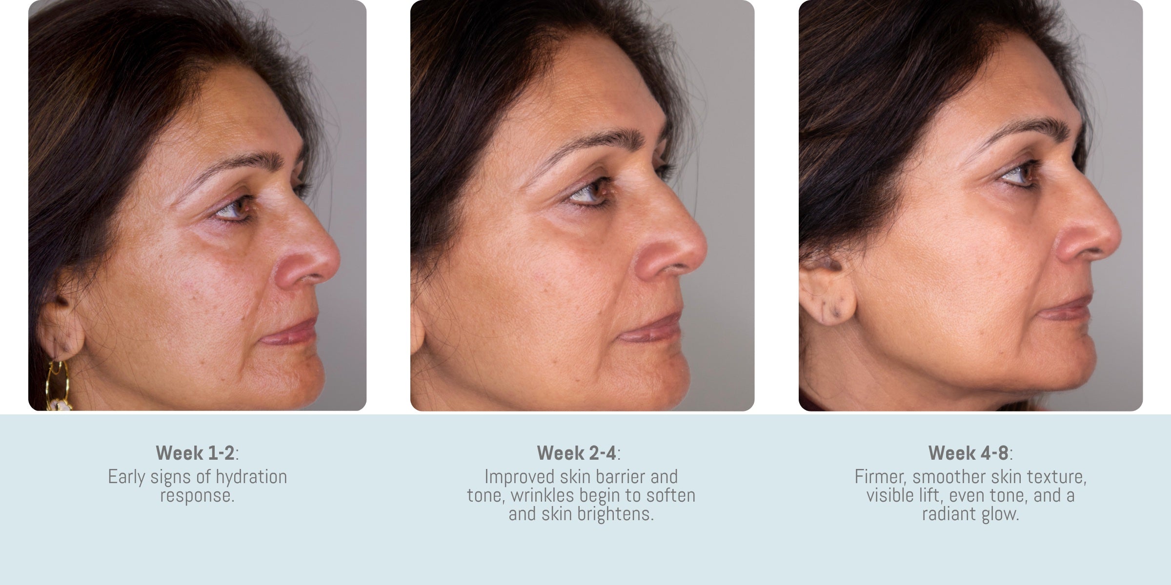 skin improvement timeline 